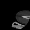 SPORK, NICO - 22.03.1976 - 02.08.2022 - CT obere Extremität - 17:51:17